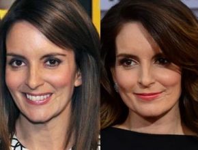 Tina Fey before and after plastic surgery