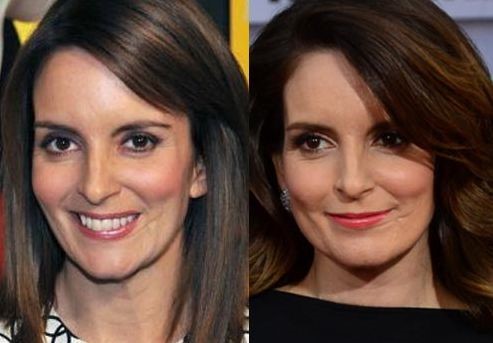 Tina Fey before and after plastic surgery