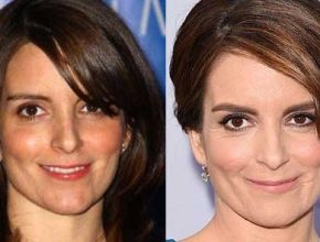 Tina Fey before and after plastic surgery 39