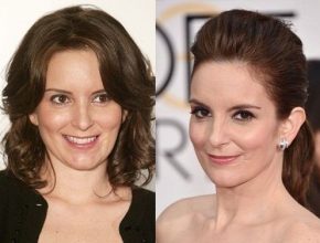 Tina Fey plastic surgery 4