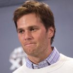 Tom Brady plastic surgery 15