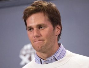 Tom Brady plastic surgery 15