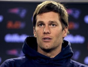 Tom Brady plastic surgery 17