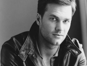 Tom Brady plastic surgery 18