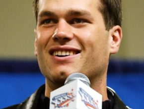toTom Brady plastic surgery 25