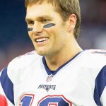 Tom Brady plastic surgery 26