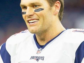 Tom Brady plastic surgery 26