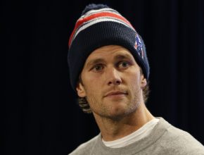 Tom Brady plastic surgery 3