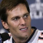 Tom Brady plastic surgery 30