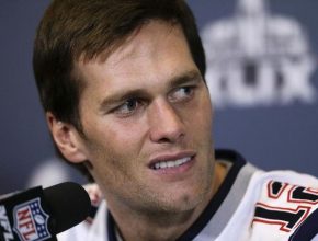 Tom Brady plastic surgery 30