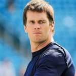 Tom Brady plastic surgery 31