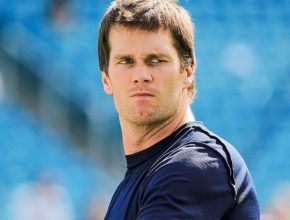 Tom Brady plastic surgery 31