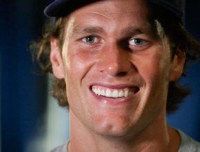 Tom Brady before plastic surgery