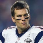 Tom Brady plastic surgery 4