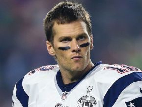 Tom Brady plastic surgery 4