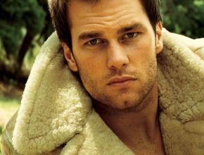 Tom Brady plastic surgery 5