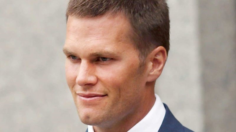 Tom Brady plastic surgery