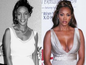 Vivica A Fox before and after plastic surgery