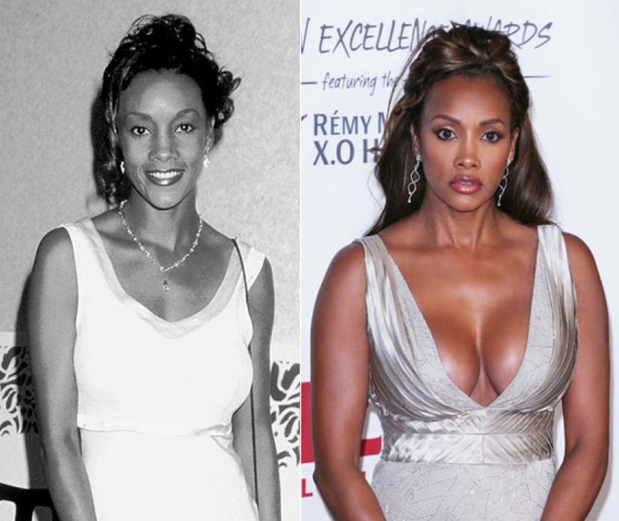 Vivica A Fox before and after plastic surgery