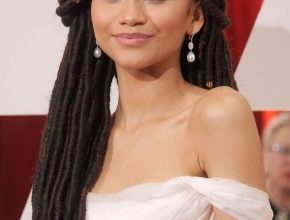 Zendaya Coleman plastic surgery 15