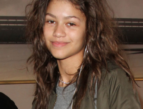 Zendaya Coleman plastic surgery 2