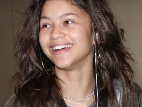 Zendaya Coleman plastic surgery 9