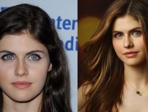 Alexandra Daddario before and after plastic surgery (1)