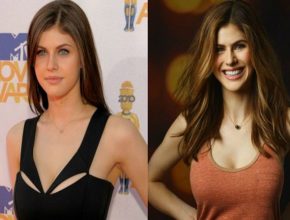 Alexandra Daddario before and after plastic surgery