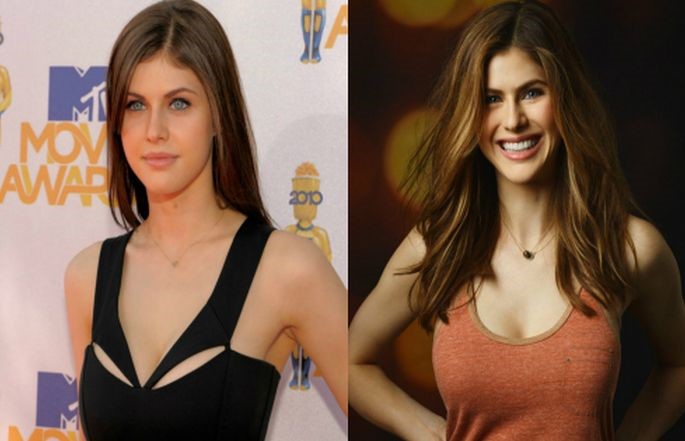 Alexandra Daddario before and after plastic surgery.