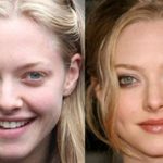 Amanda Seyfried before and after plastic surgery (18)