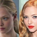 Amanda Seyfried before and after plastic surgery (19)