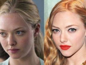 Amanda Seyfried before and after plastic surgery (19)