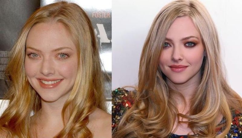 Amanda Seyfried plastic surgery