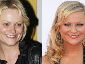 Amy Poehler before and after plastic surgery