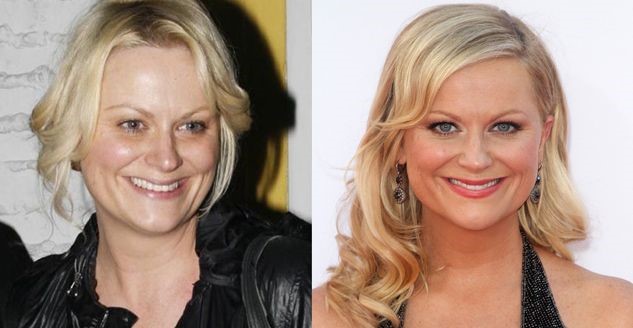 Amy Poehler befo and after plastic surgery
