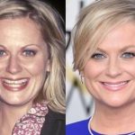 Amy Poehler before and after plastic surgery (32)