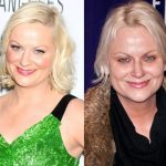 Amy Poehler before and after plastic surgery (33)