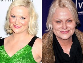 Amy Poehler before and after plastic surgery (33)
