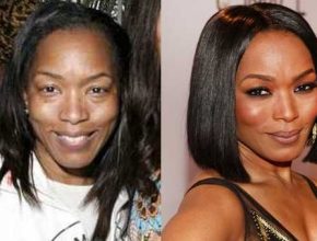 Angela Bassett before and after plastic surgery (13)