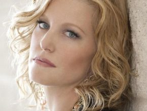 Anna Gunn plastic surgery (1)