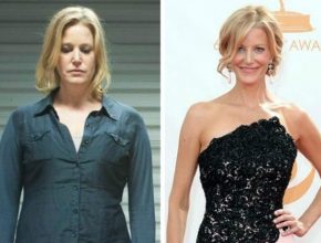 Anna Gunn plastic surgery (12)