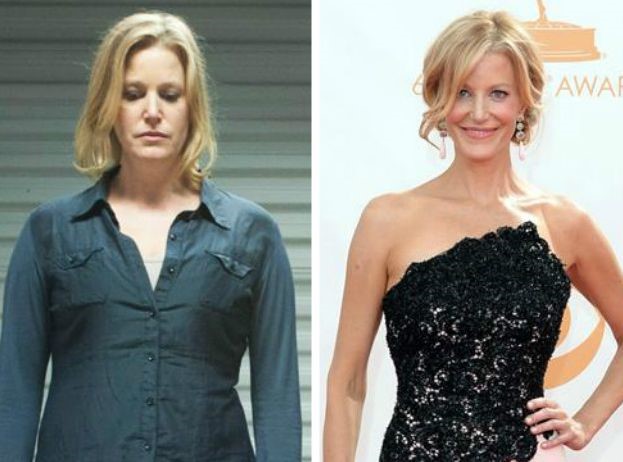 Anna Gunn plastic surgery (12) .