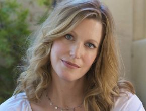 Anna Gunn plastic surgery (2)