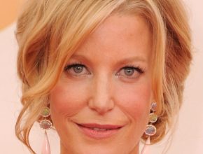 Anna Gunn plastic surgery (21)