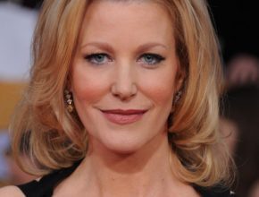 Anna Gunn plastic surgery (23)