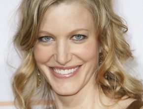 Anna Gunn plastic surgery