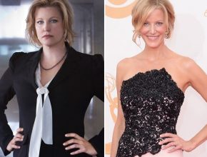 Anna Gunn plastic surgery (27)