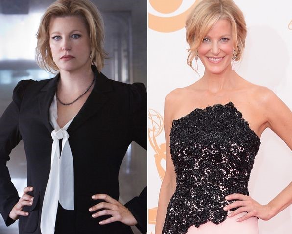 Anna Gunn plastic surgery (27) .