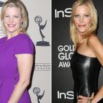 Anna Gunn plastic surgery (29)