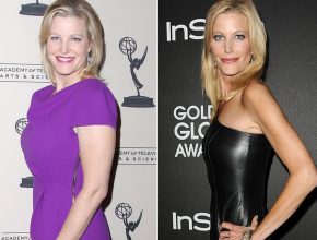 Anna Gunn plastic surgery (29)